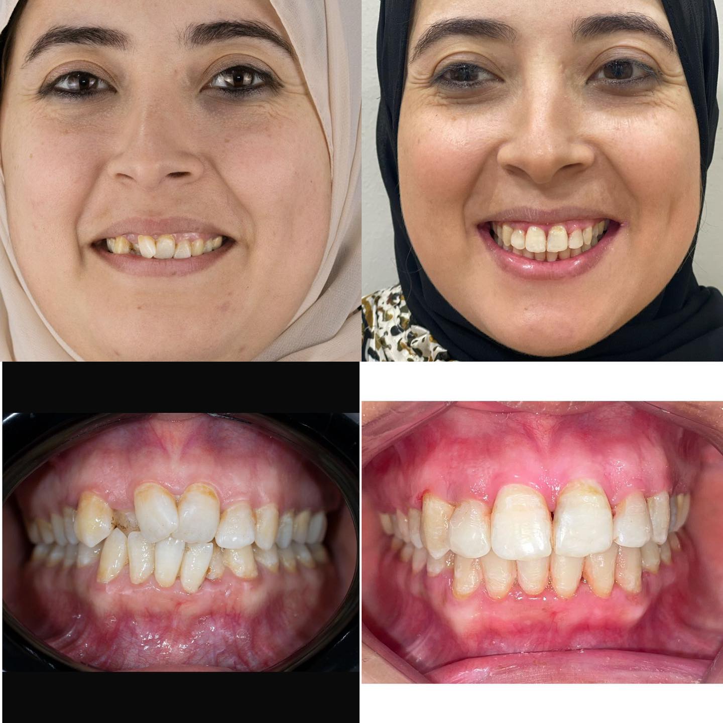 Dr.Smile Dental Clinic - لزراعة وتجميل الأسنان Facebook ad