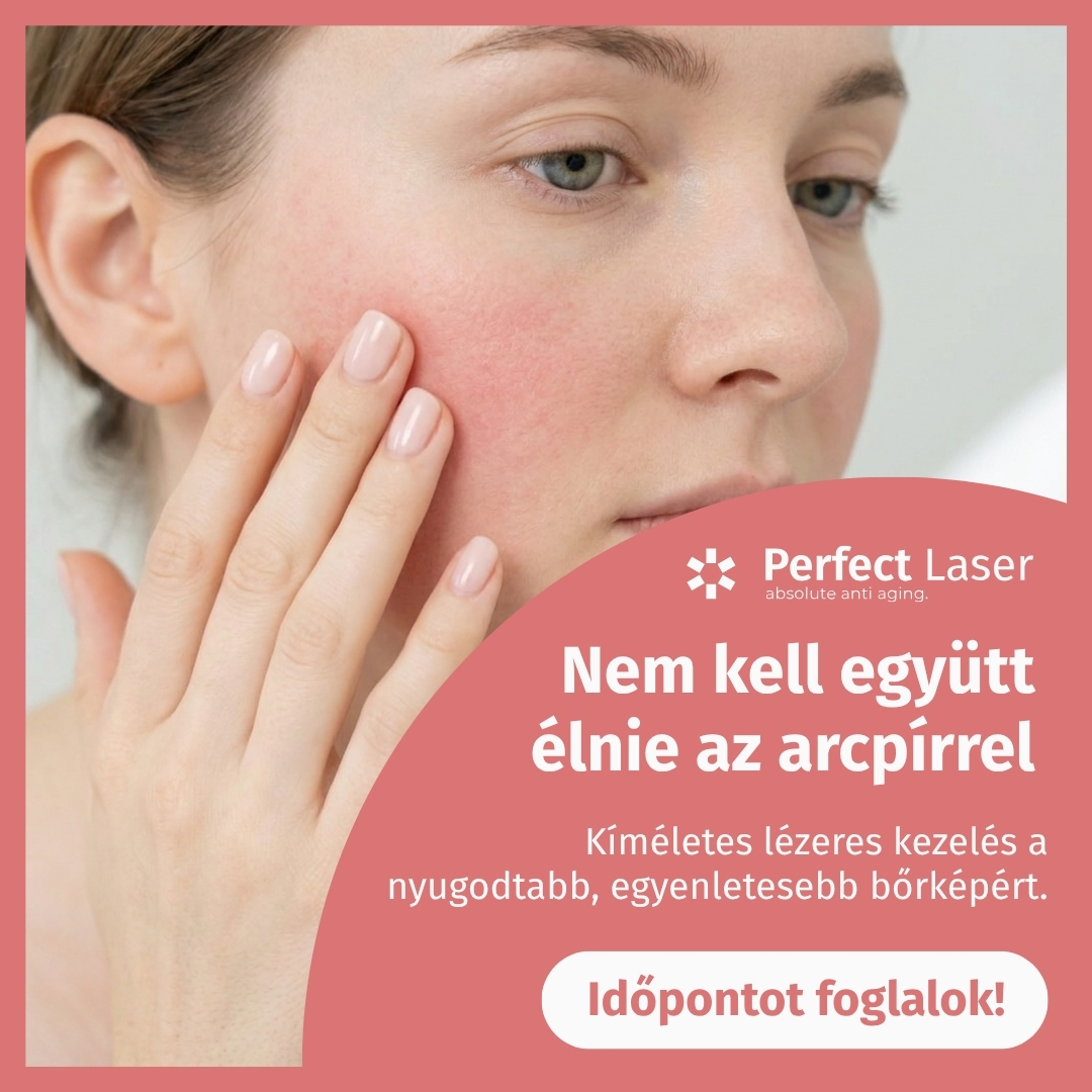 Perfect LASER Facebook ad