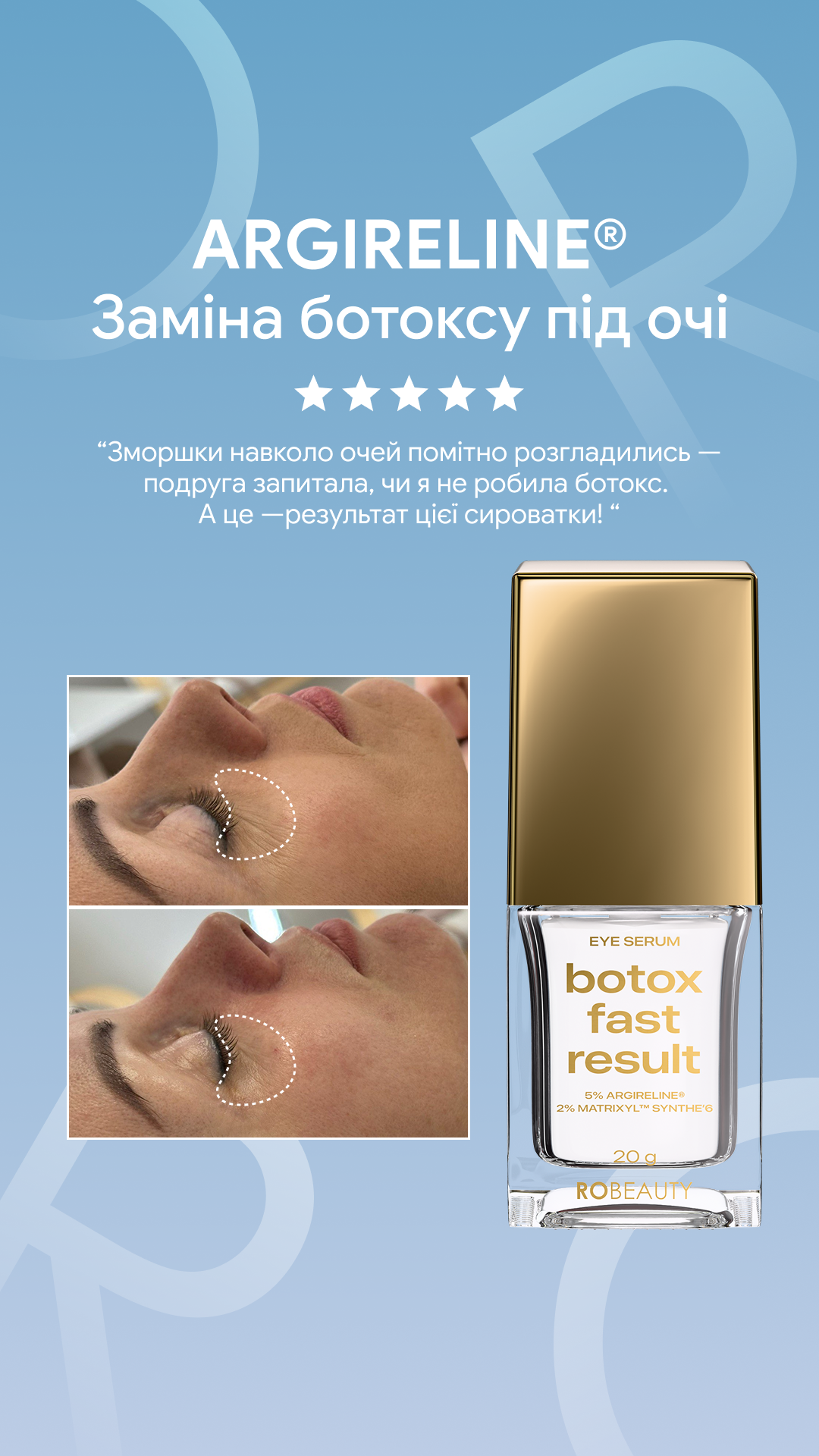Robeauty Facebook ad
