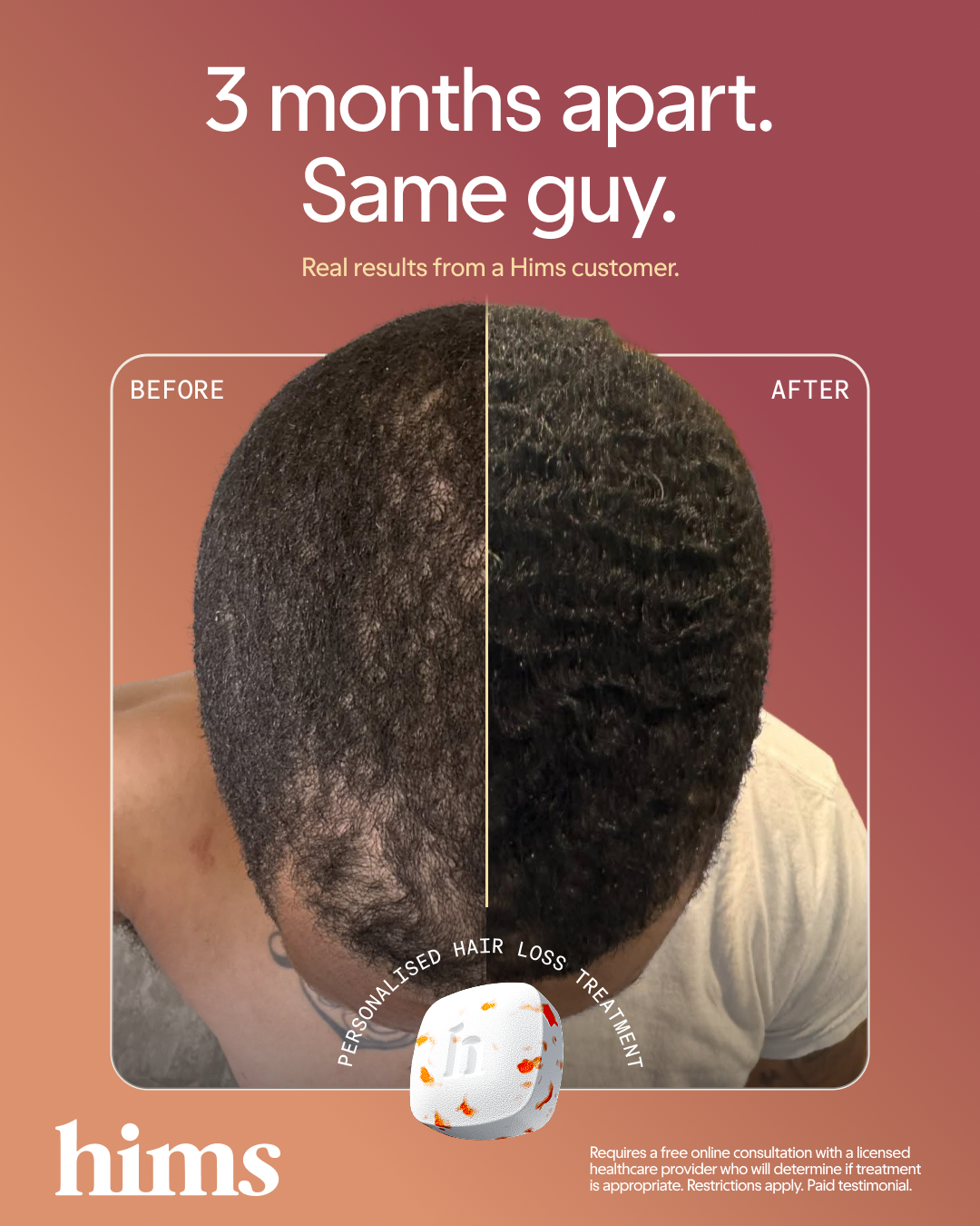 hims Facebook ad: Time to see the difference!
