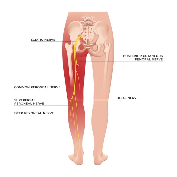 DCOA Baton Rouge & New Roads Facebook ad: $49 Spinal Decompression Evaluation (Reg. $350)