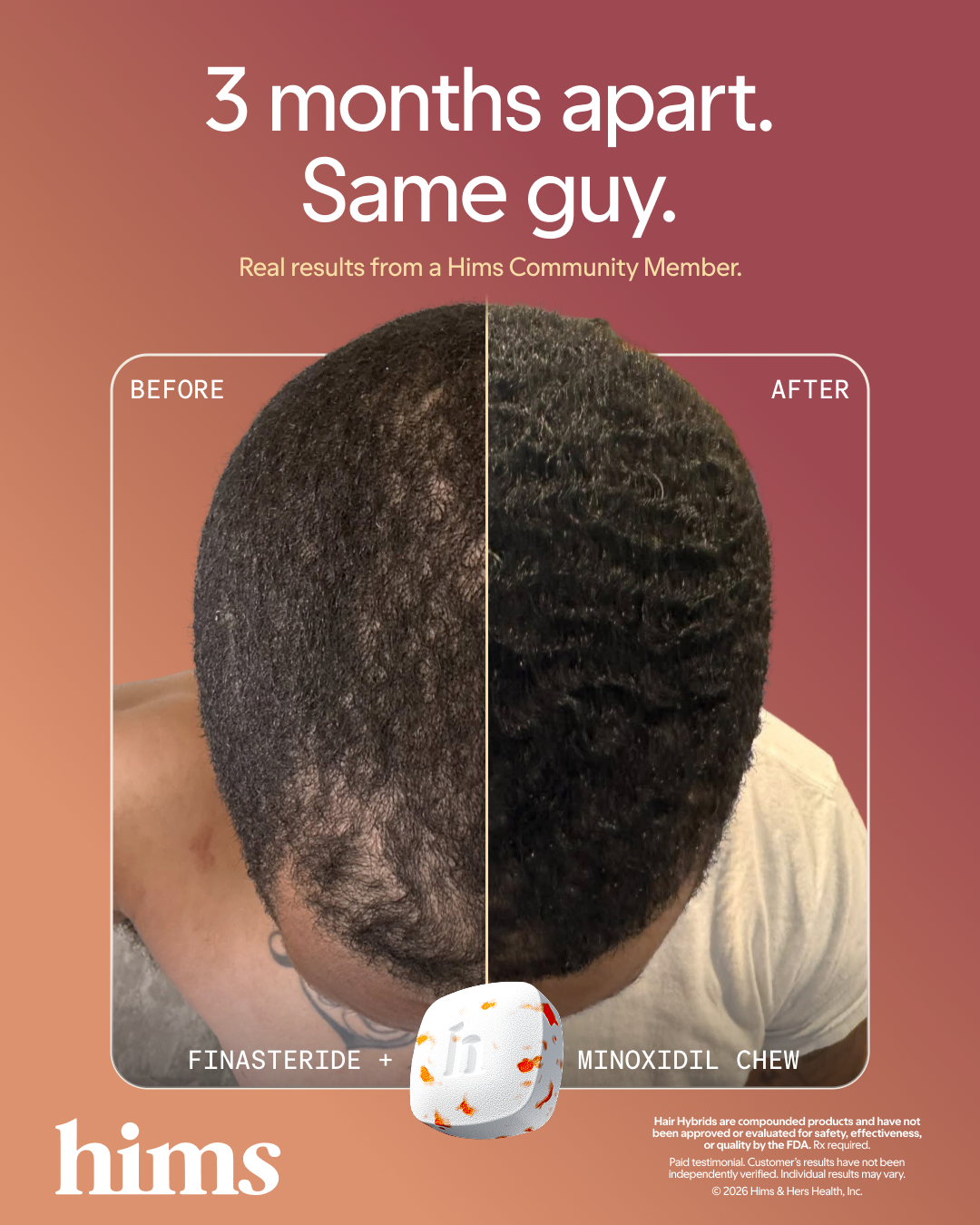 hims Facebook ad: Get started today