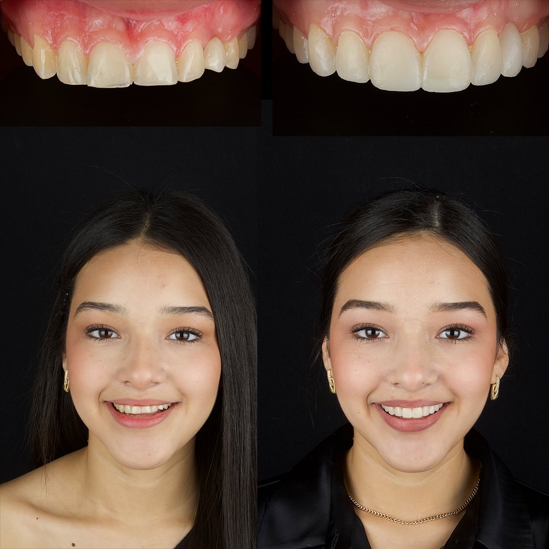 Dr. Sergio Garza Rehabilitación y Estética Dental Facebook ad: Diseño de sonrisa.