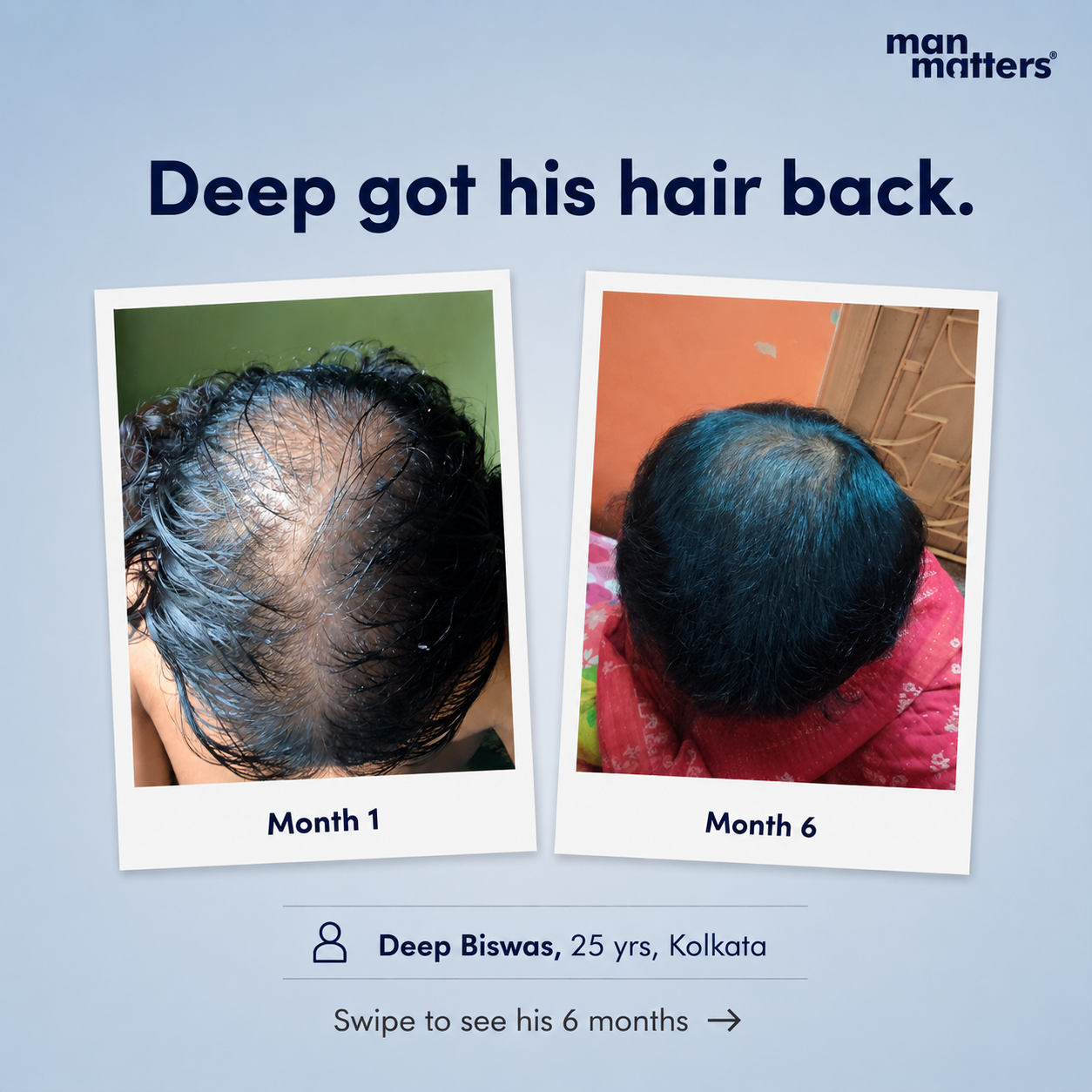 manmattershairwarriors Facebook ad