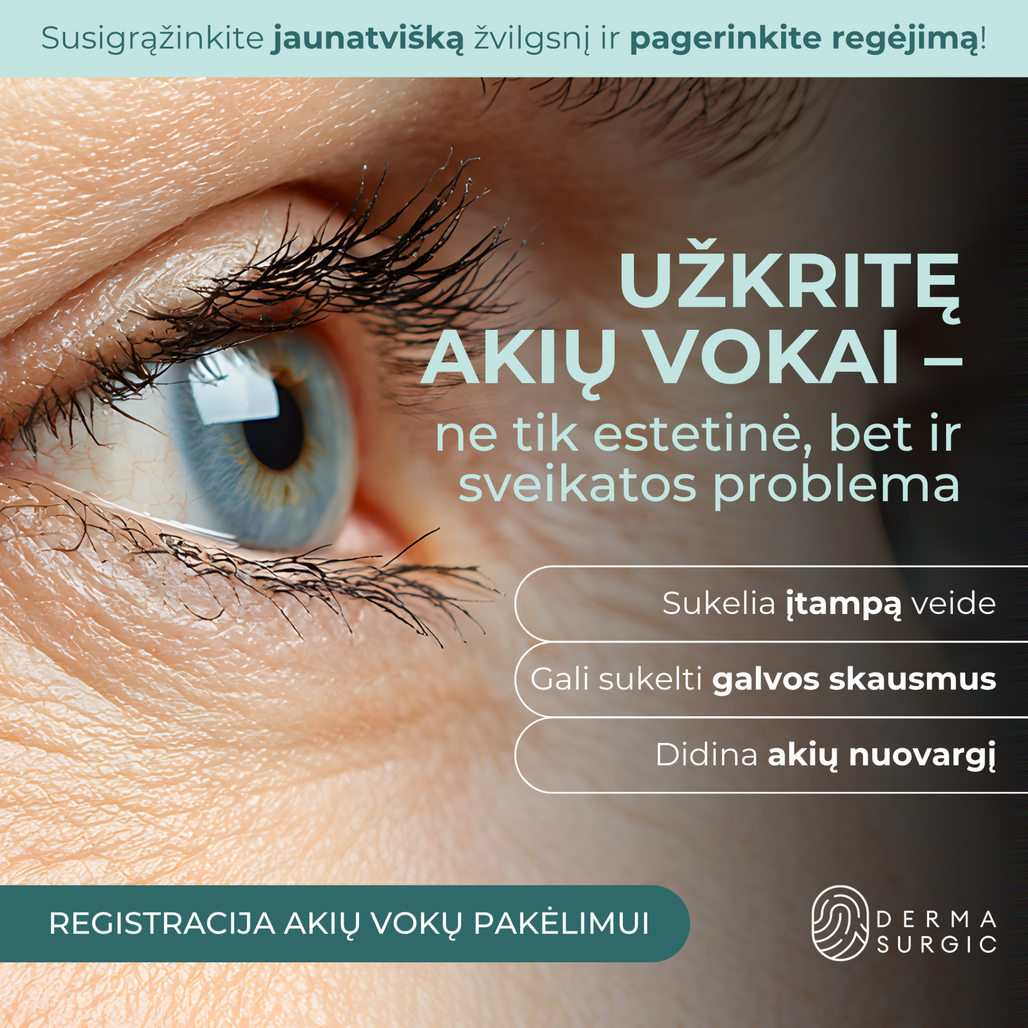 DermaSurgic estetinės medicinos ir chirurgijos centras Facebook ad: Pavargusioms akims | Akių vokų pakėlimo operacija