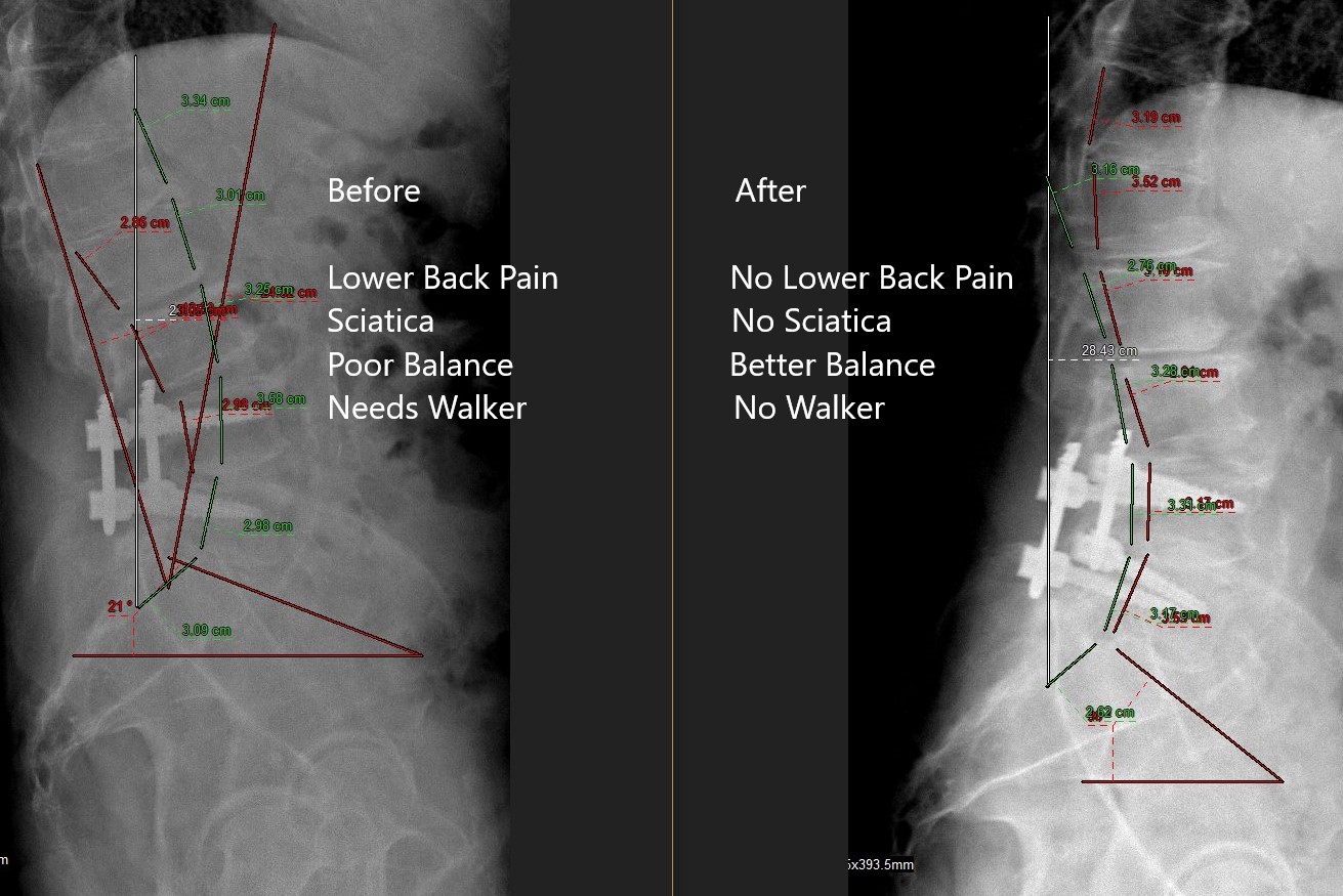 Watts Chiropractic Center Facebook ad