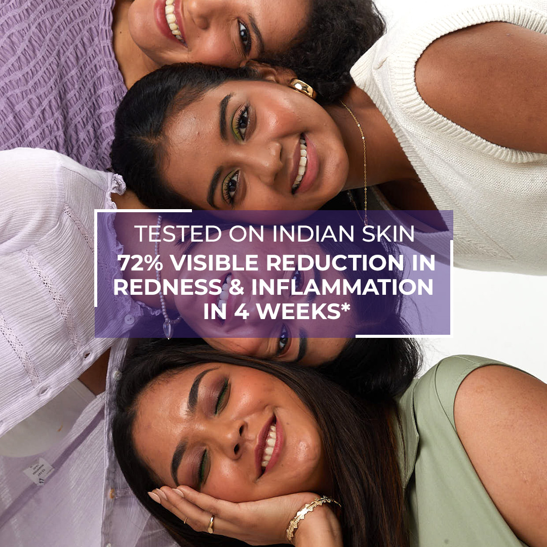 AcneStar Facebook ad: Real acne needs real science.