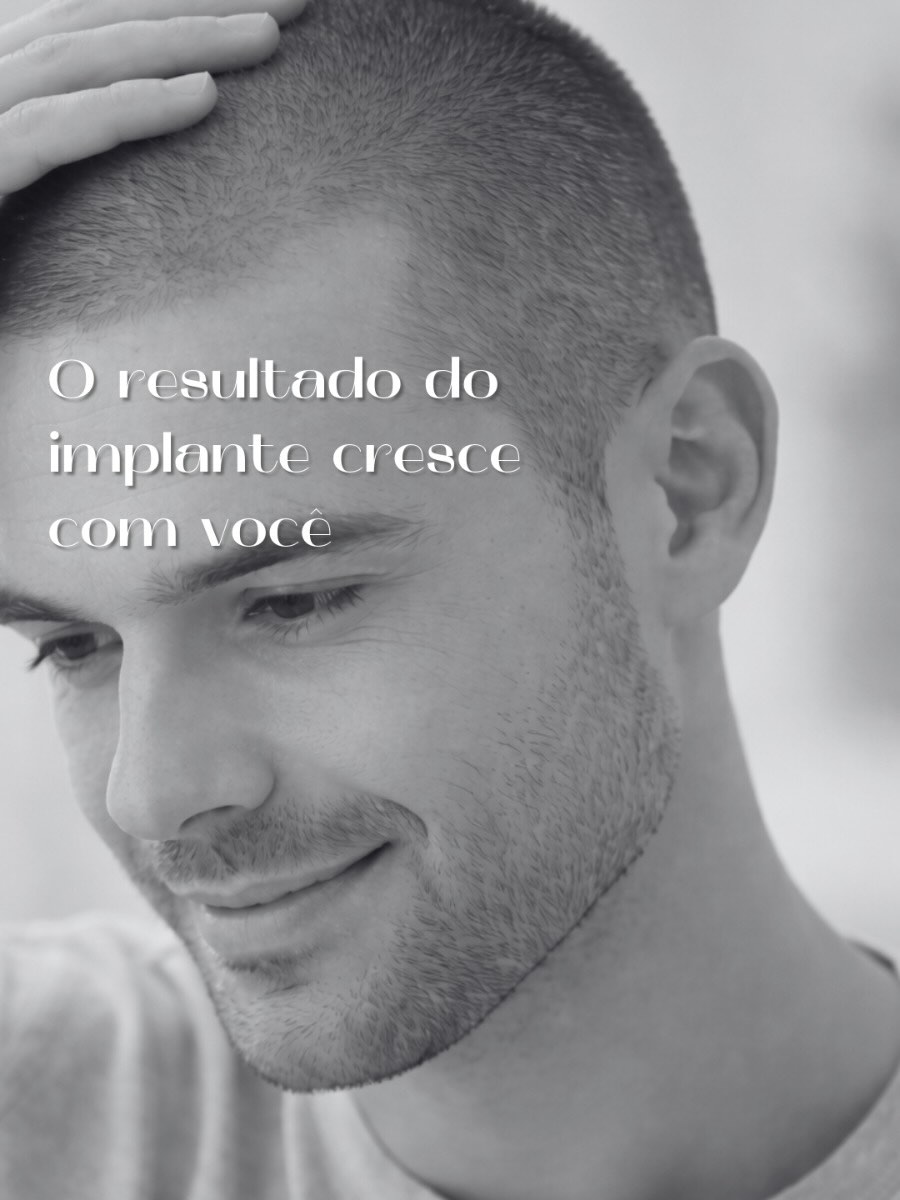 Dr. Filipe Canal - Cirurgião Plástico Facebook ad: A evolução de um implante capilar não acontece…