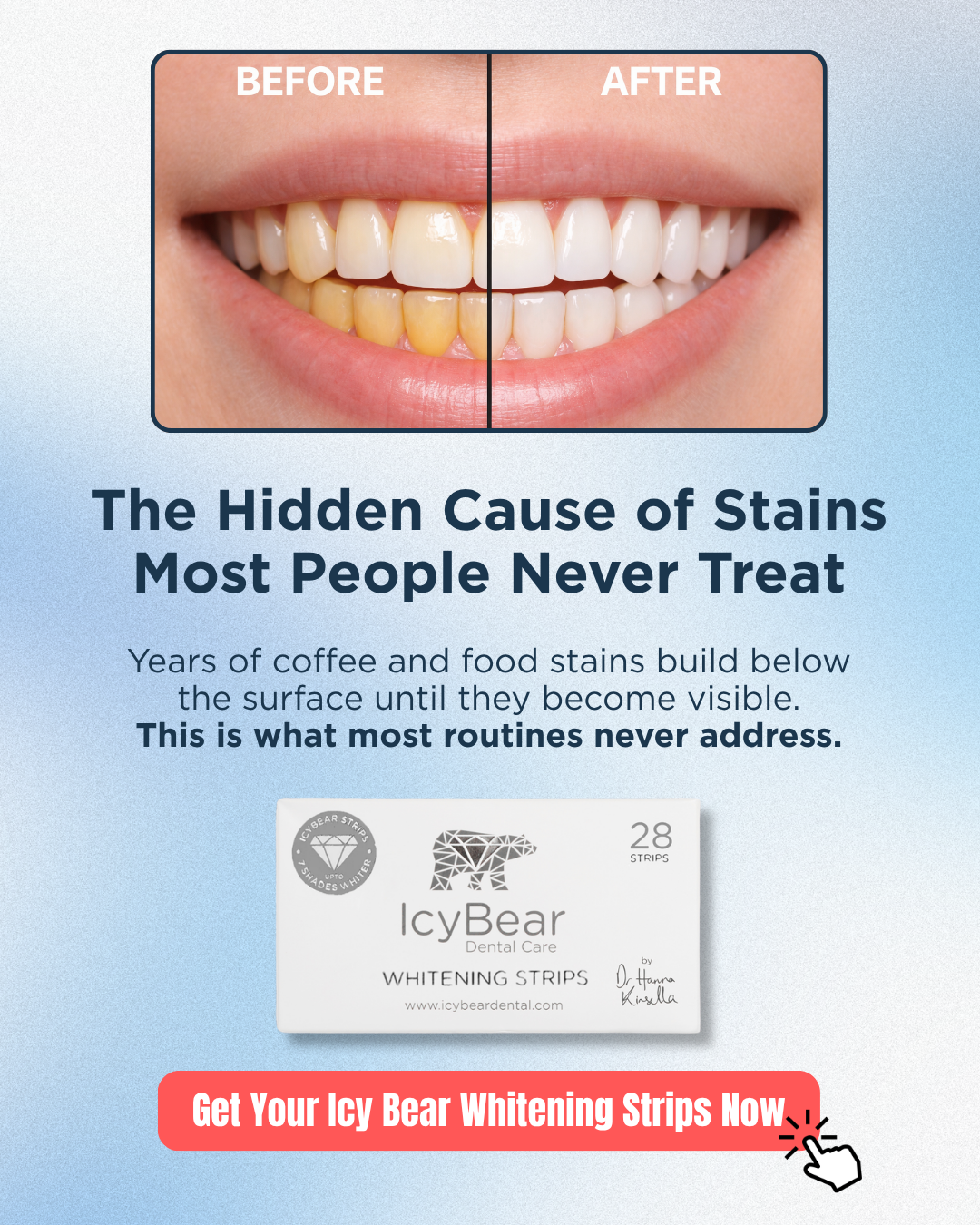 Icy Bear Dental Facebook ad