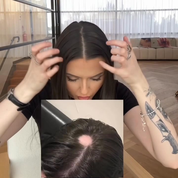 Liquid Locks Australia Facebook ad: 70% reported reduced appearance of hair shedding.