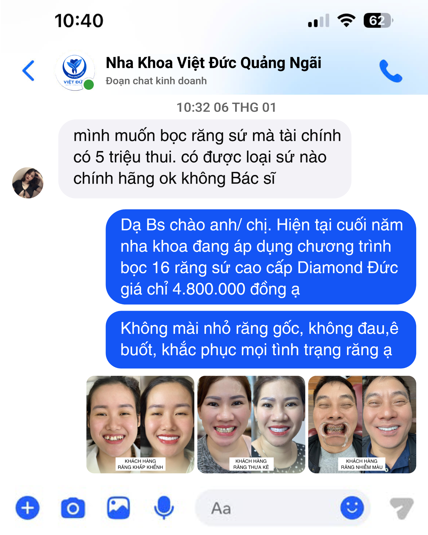 Nha Khoa Thẩm Mỹ Việt Đức international - chi nhánh Quảng Ngãi Facebook ad: Nhắn tin nhận ngay ưu đãi kẻo về giá gốc
