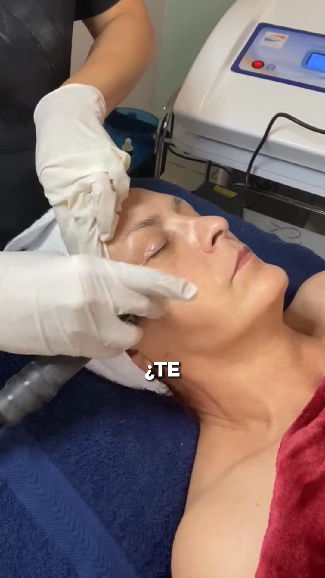 Aura Estetic Facebook ad: REJUVENECE TU ROSTRO