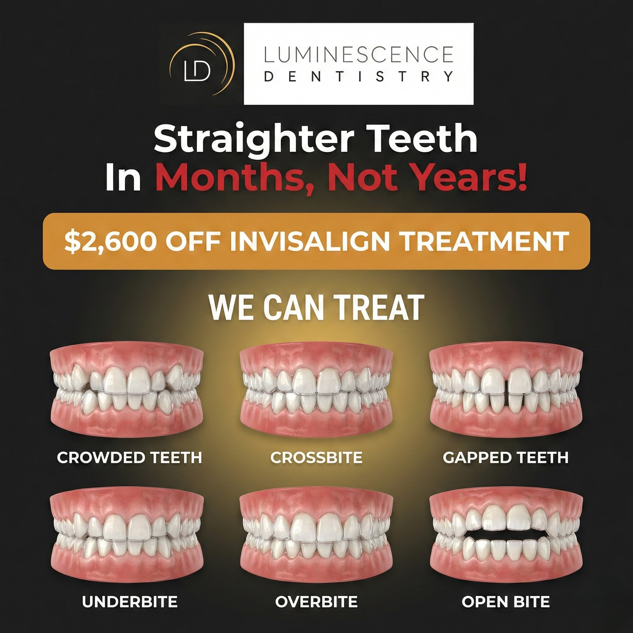 Luminescence Dentistry Facebook ad