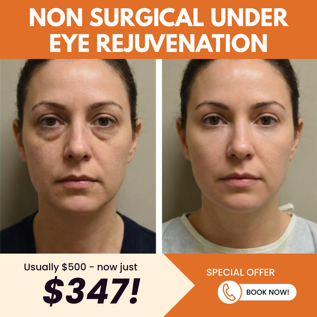 Grace & Wellness Facebook ad: Non Surgical Under Eye Rejuvenation - JUST $347!