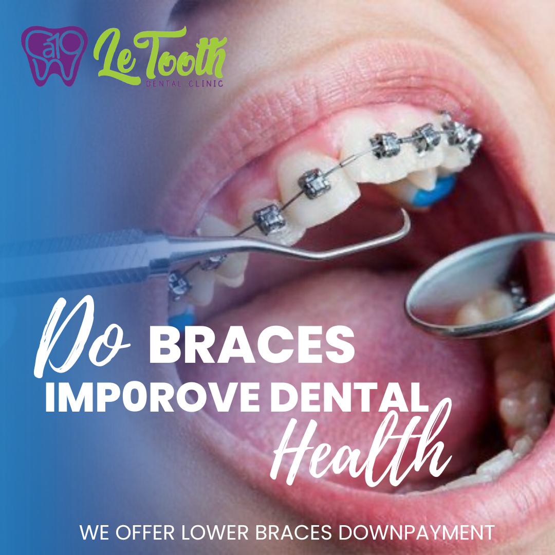 Sa19 Le Tooth Dental Clinic - Somo Vista Mall Facebook ad: Summer Package!