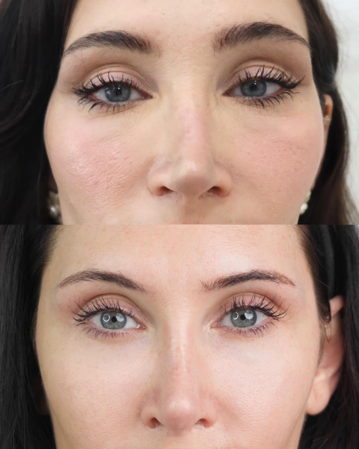 glosclinic Facebook ad