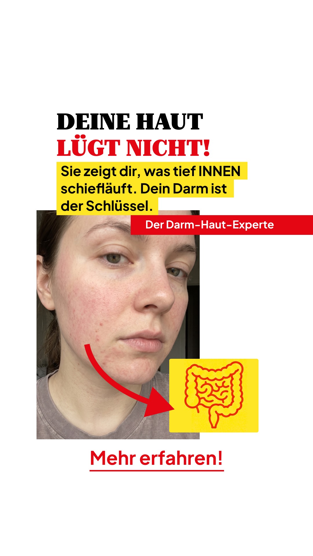 Zentrum Darmgesundheit Facebook ad: SCHLUSS MIT DEN SCHÜBEN!