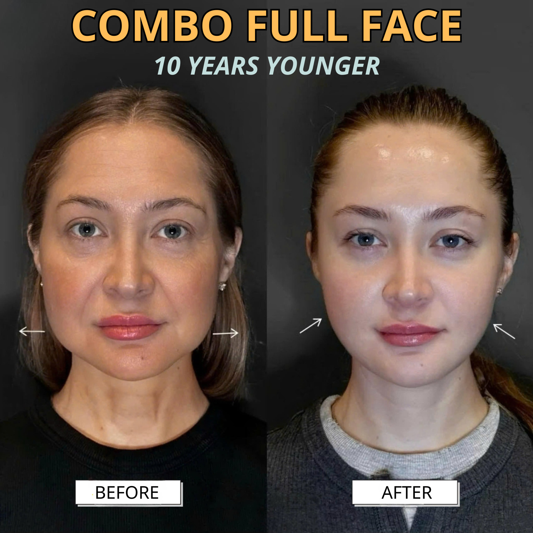 Korean Skin Rejuvenation Technology Facebook ad