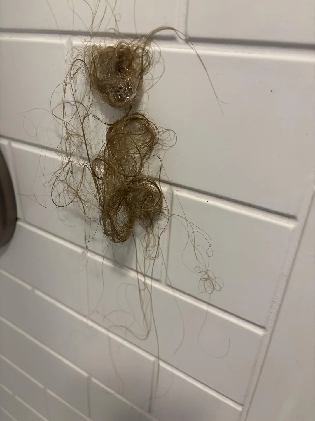 Karen Pascale, dermatologist Facebook ad: Goodbye To Hair Thinning