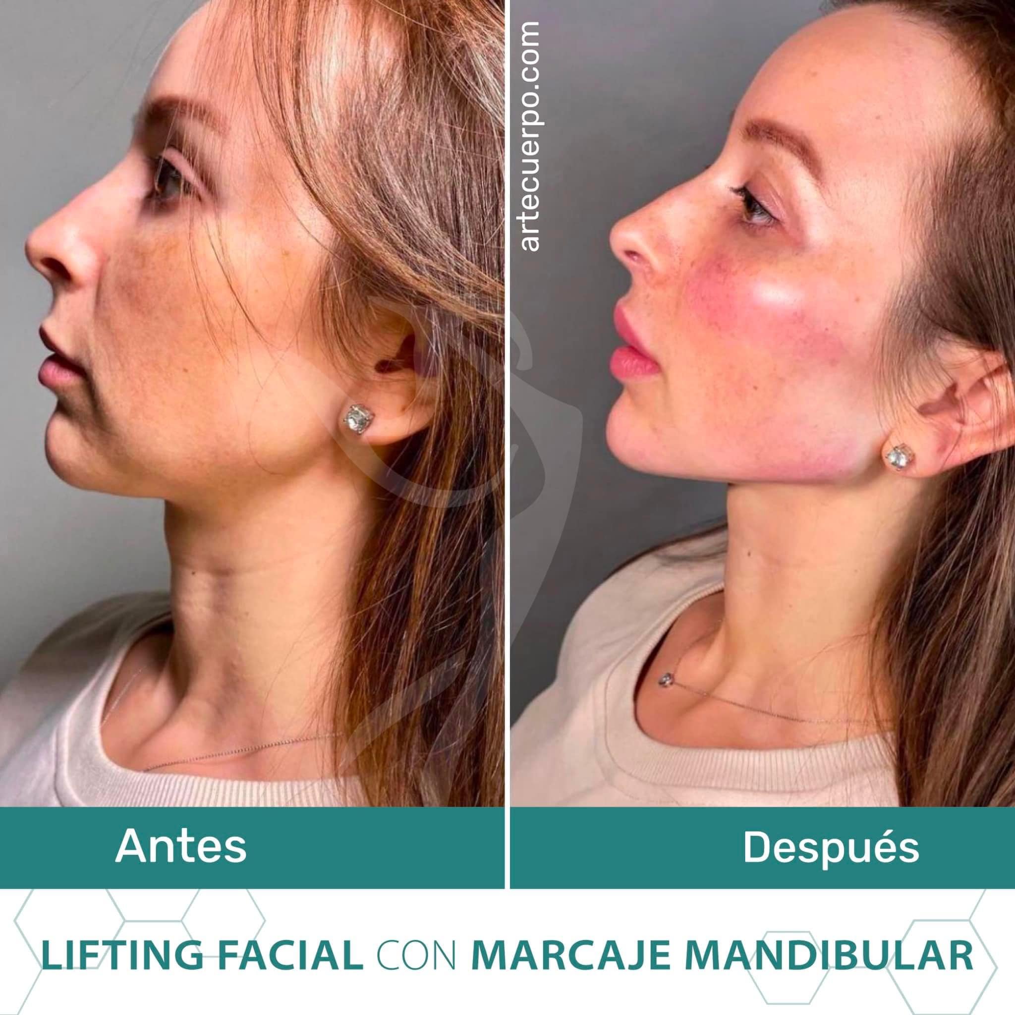 Clinica spa arte cuerpo  Facebook ad