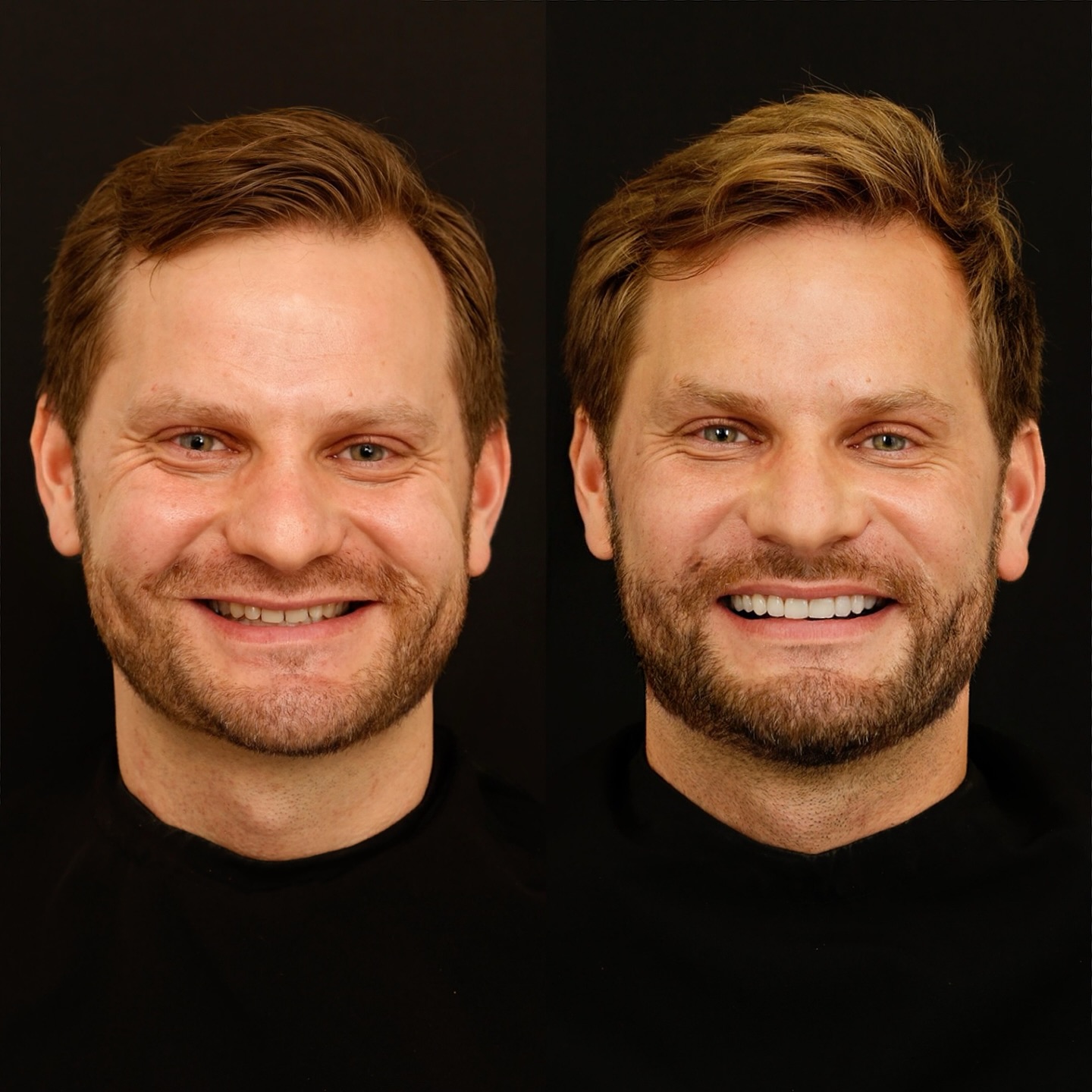 Rildo Lasmar Odontologia e Estética Facebook ad
