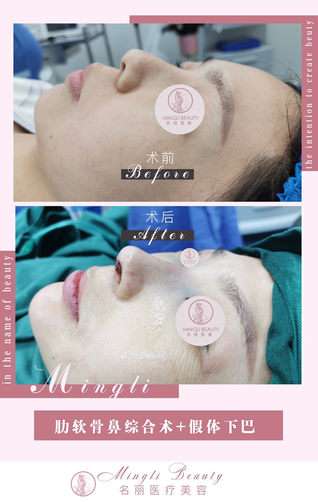 Guangzhou Cosmetic Clinic Facebook ad