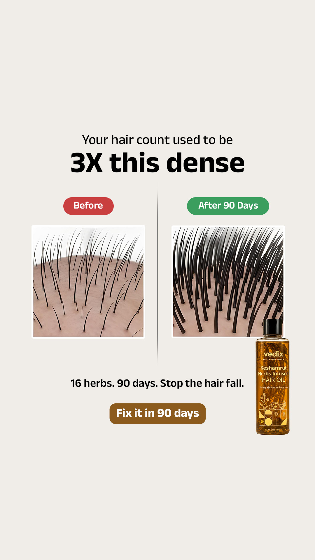 Vedix_UAE Facebook ad: Vedix Keshamrut Hair Growth Oil For Men