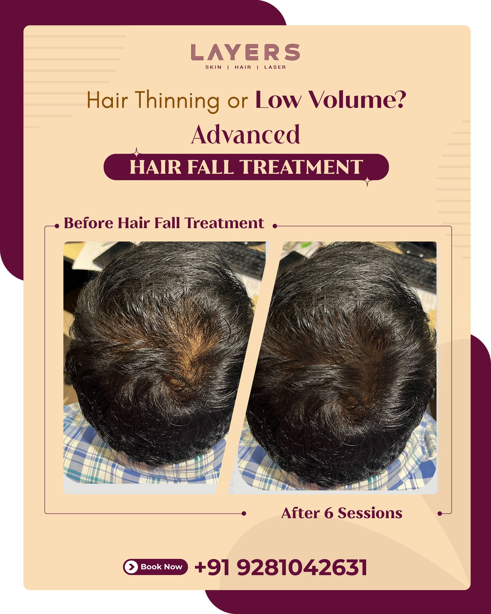Layers Clinics Facebook ad