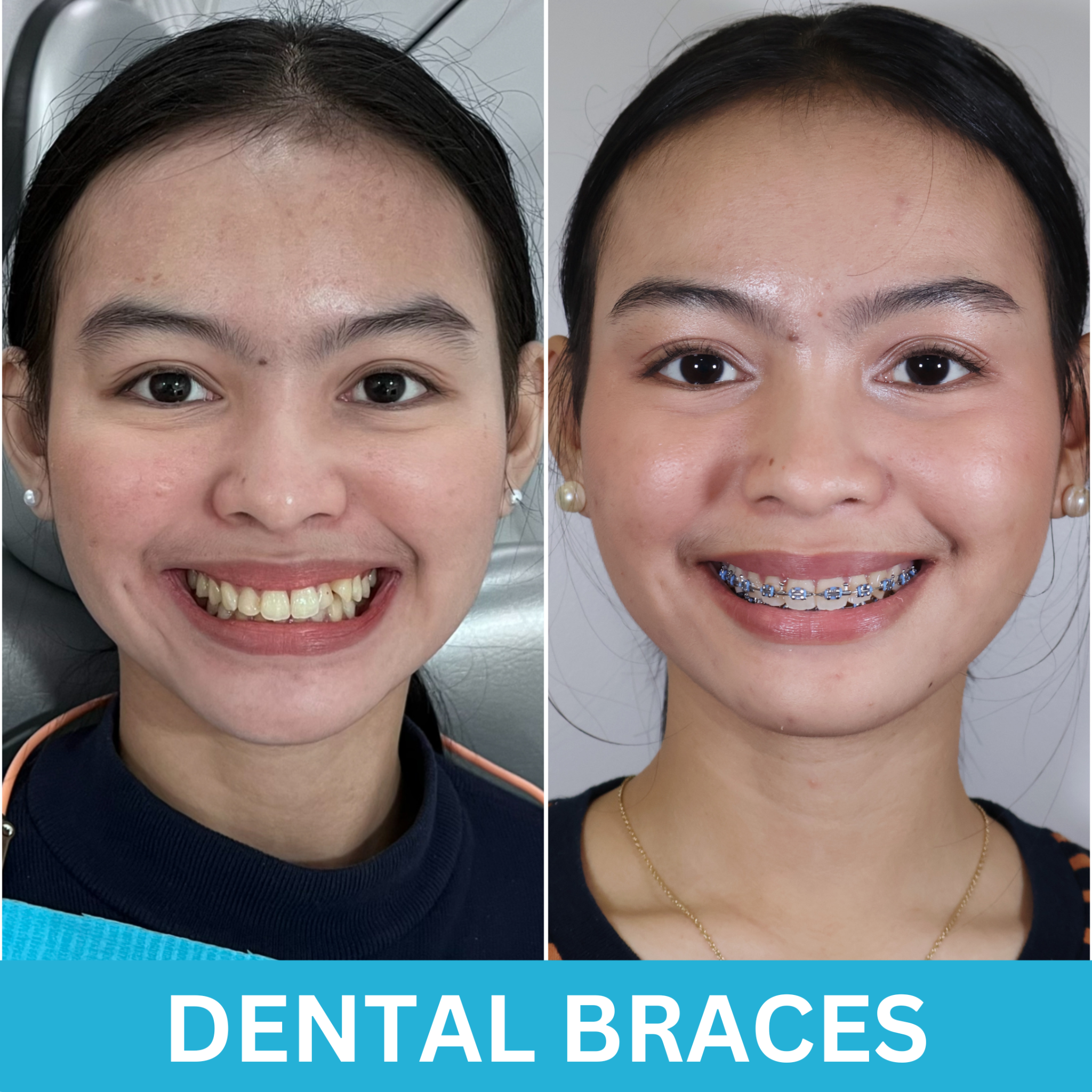 Ivory Smile Dental Clinic - Makati Branch Facebook ad from Jan 5, 2025