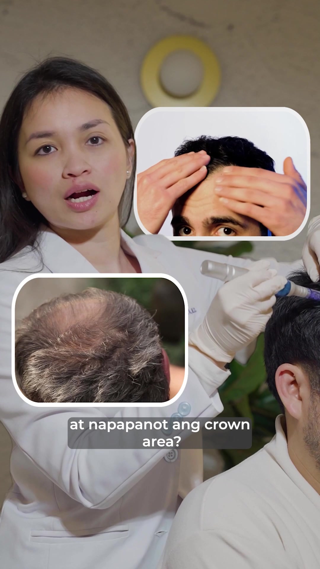 TBL Manila Aesthetic & Laser Center Facebook ad: Start your hair growth journey today