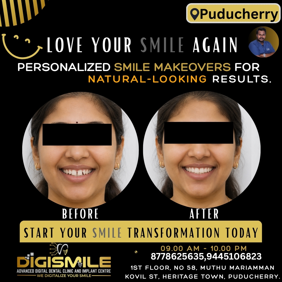 Digismile Advanced Digital Dental Clinic and Implant Centre Facebook ad: Your Dream Smile is Just a Visit Away!