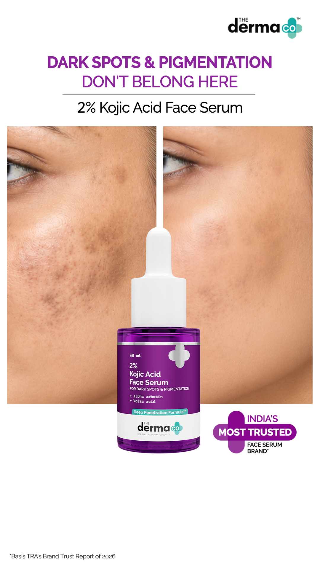 The Derma Co. Facebook ad