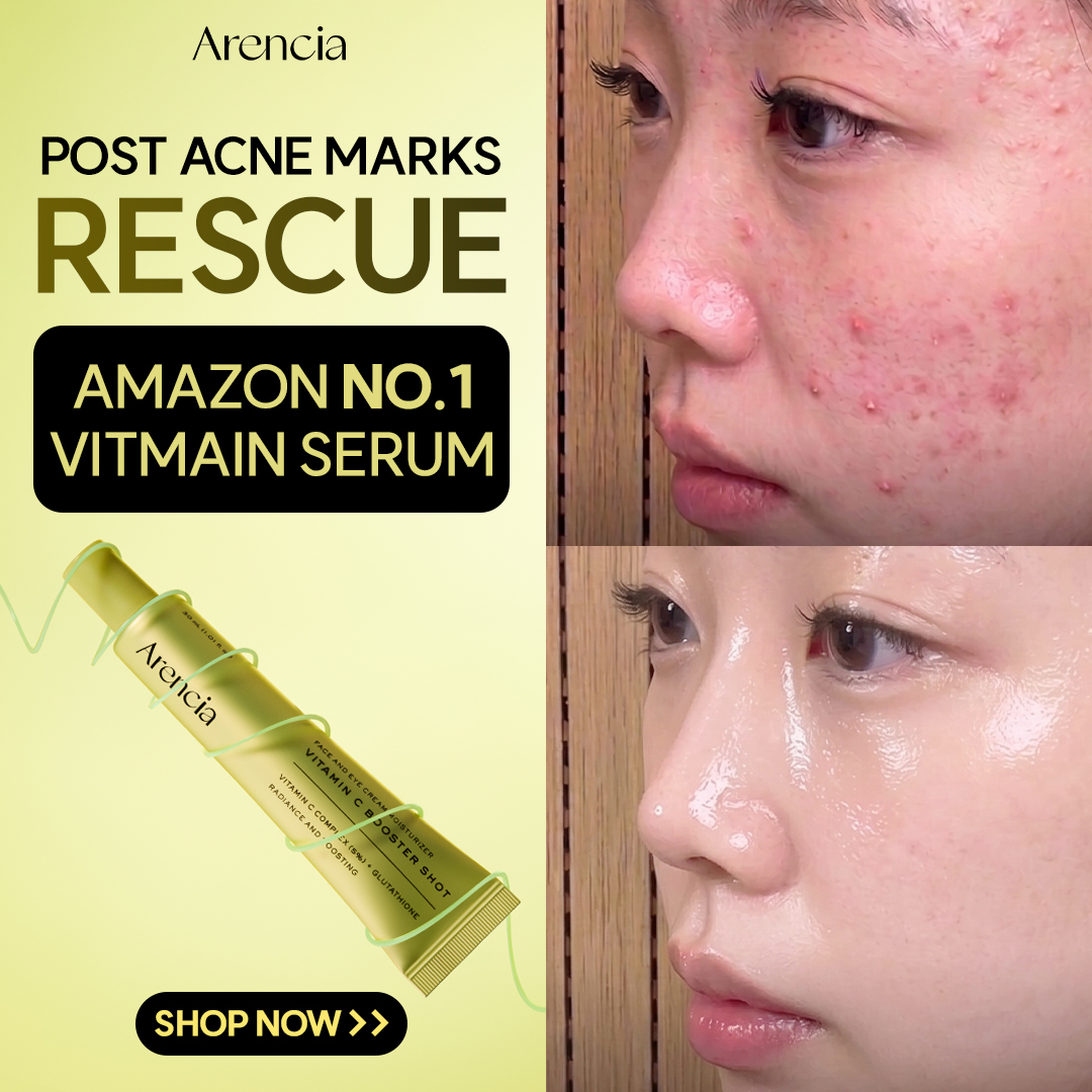Arencia Global Facebook ad