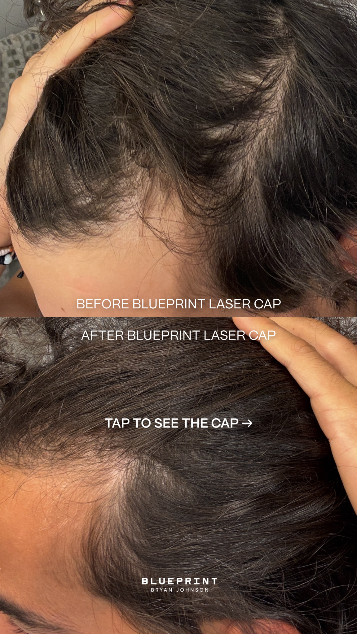 Blueprint Longevity Facebook ad: Reverse hair loss in 16 weeks.