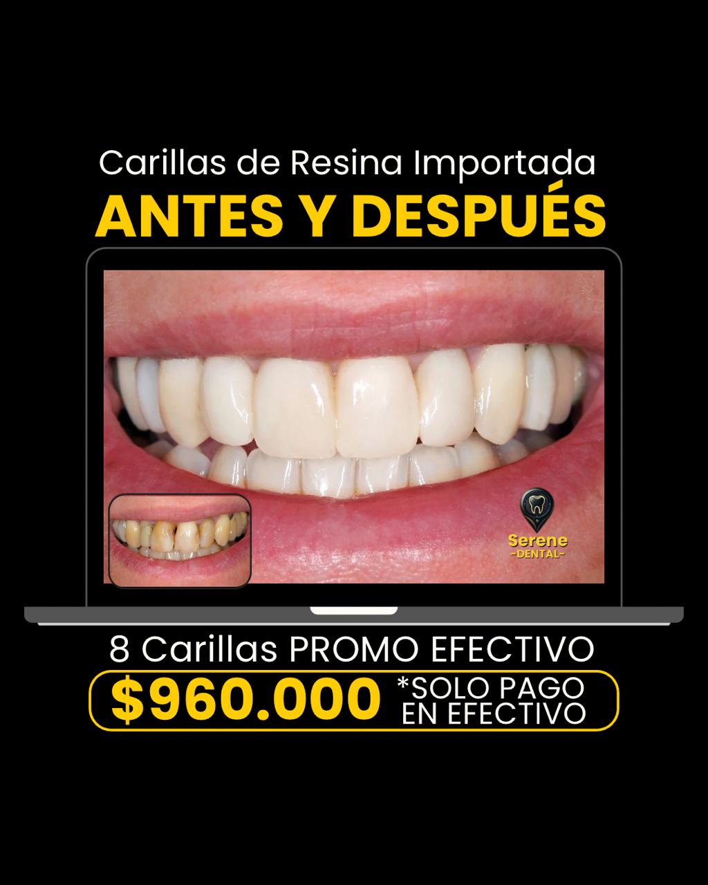 Serene Dental Facebook ad from Aug 7, 2026