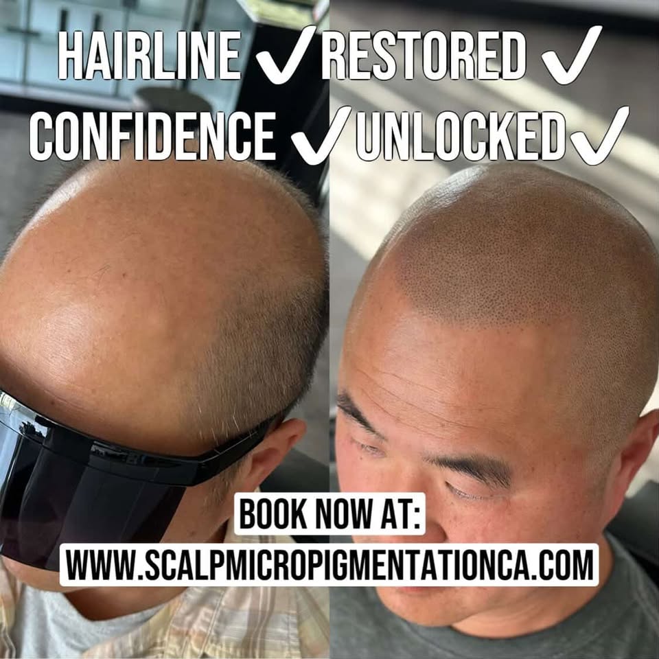 Scalp Micropigmentation CA - SMPCA Academy Facebook ad