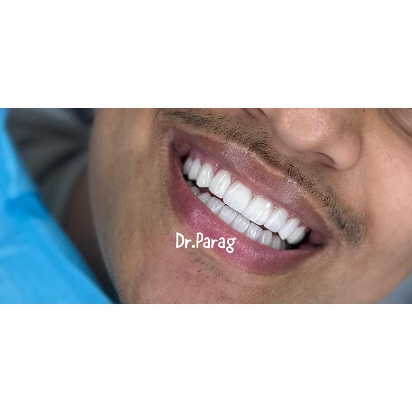 Dr.parag.pitti Facebook ad: LIMITED TIME OFFER!