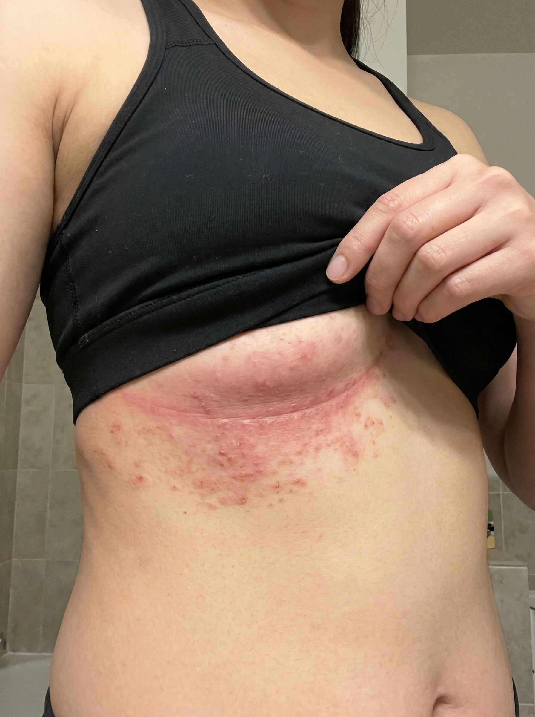 Her Health Hub Facebook ad: What Dermatologists WON'T Tell You About Underboob Rash