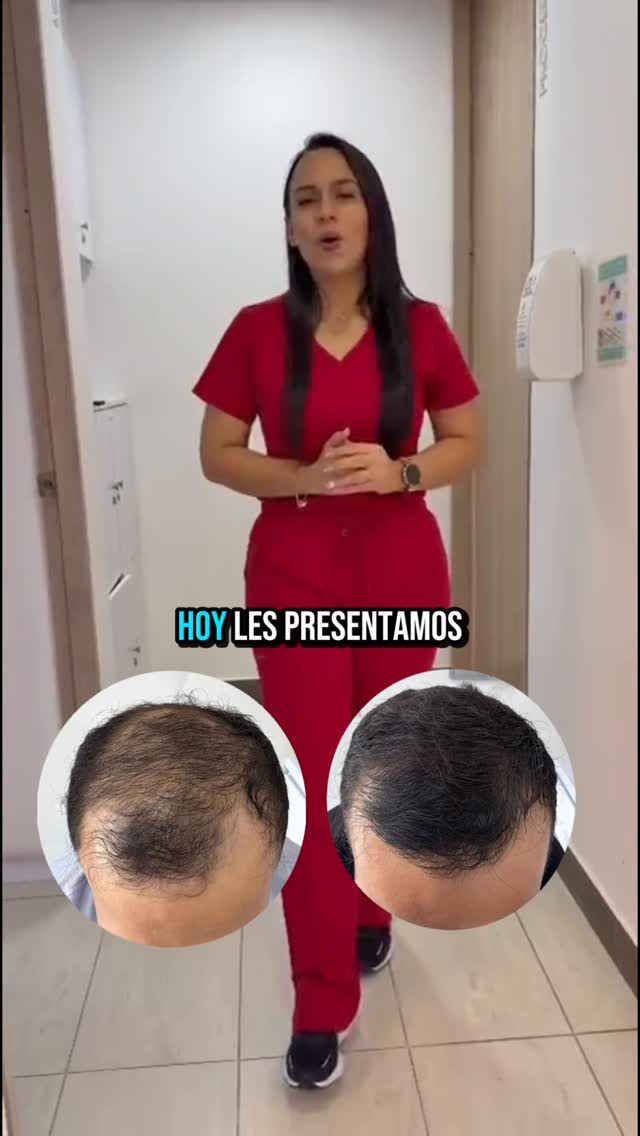 Mediarte implante capilar Villavicencio Facebook ad: Si estás viendo caer tu cabello