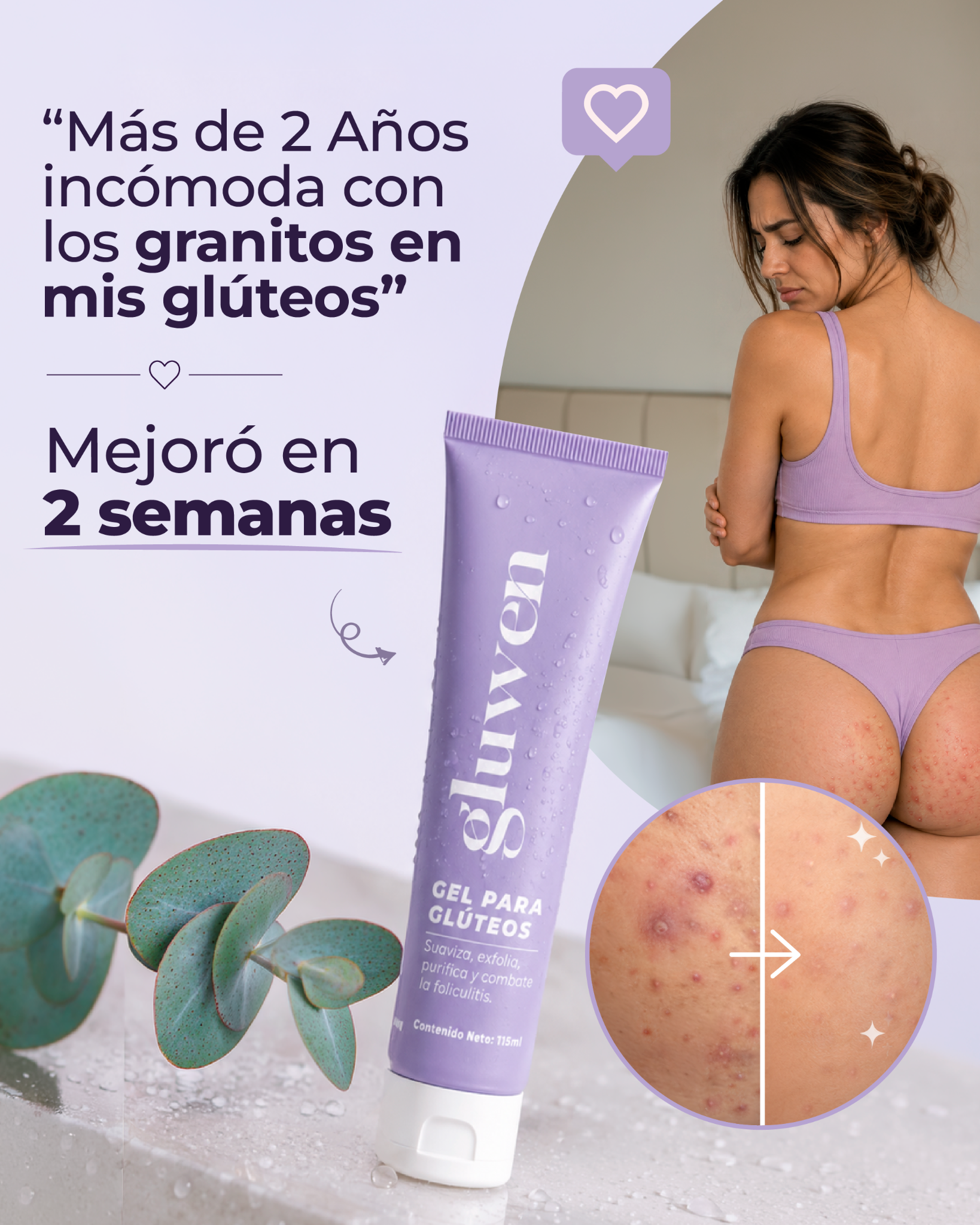 Gluwen Colombia Facebook ad: Más de 2 años incómoda con los granitos en mis glúteos