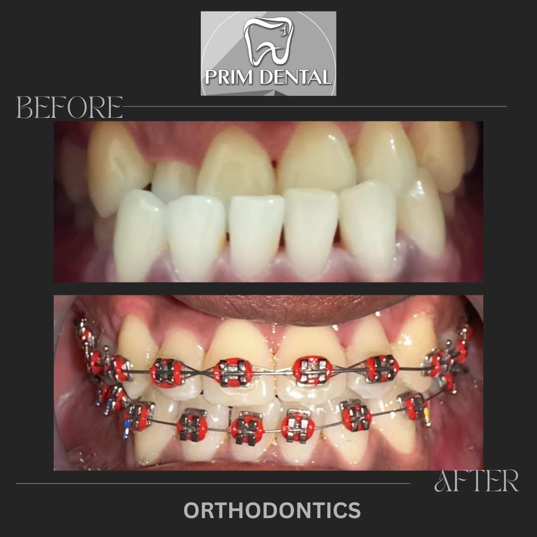 Prim Dental Facebook ad: PRIM DENTAL (Angeles City, Pampanga)