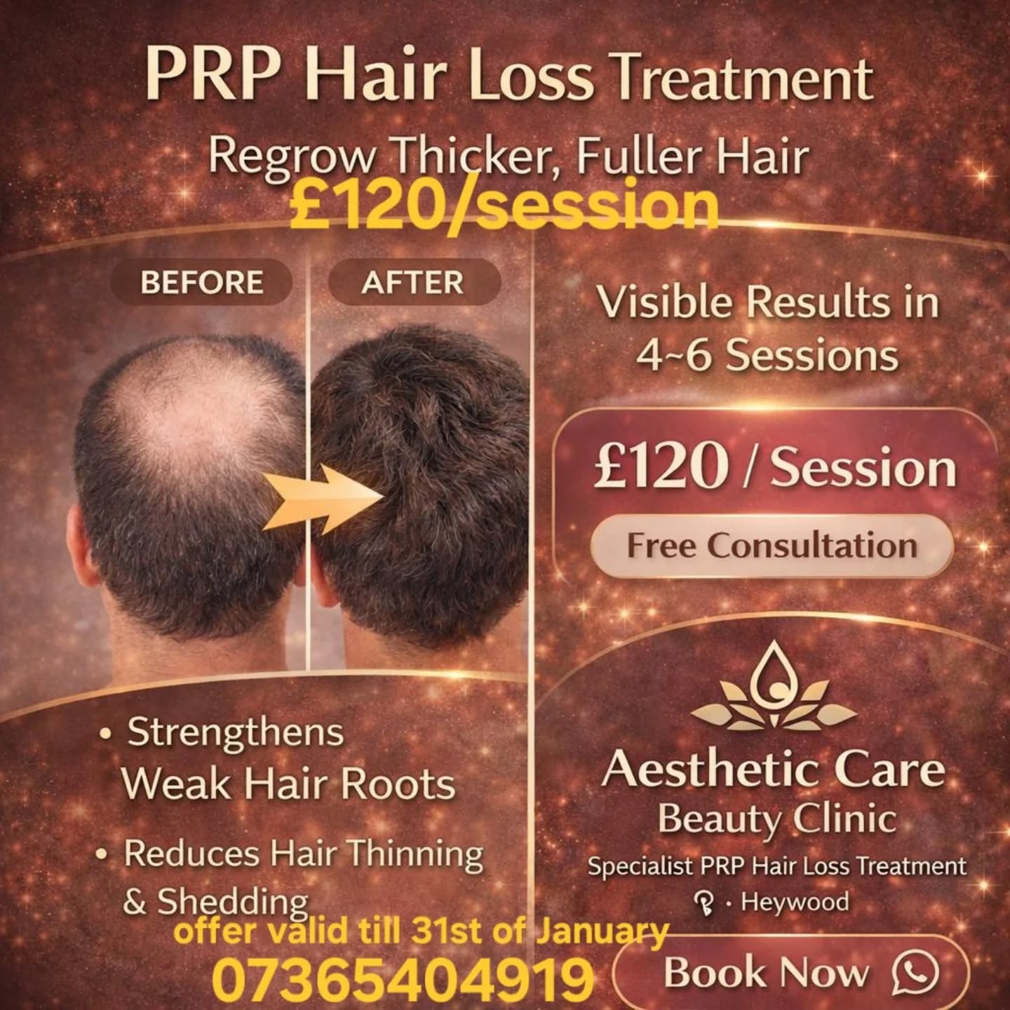 Aesthetic Care Beauty Clinic Facebook ad: New Year 2026 Hair Restoration Offer
