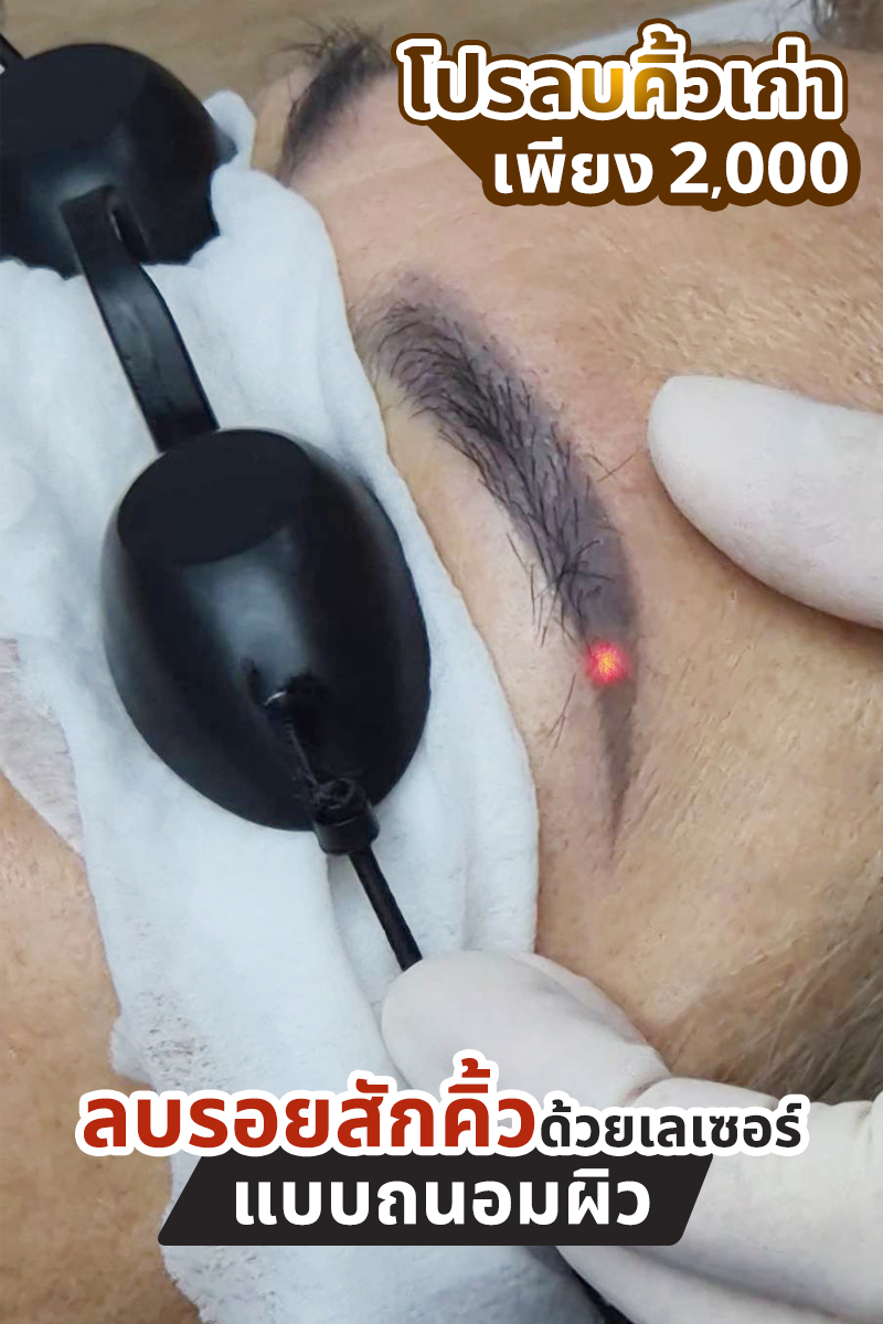 BloomBrows สักคิ้ว สักปาก สักไรผม ต่อขนตา นวดหน้า ตราด Facebook ad: เบื่อคิ้วเก่า มาลบจบปัญหา