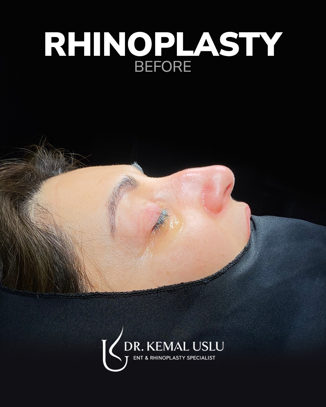 drkemaluslu Facebook ad: We are pleased to share our female patient’s…