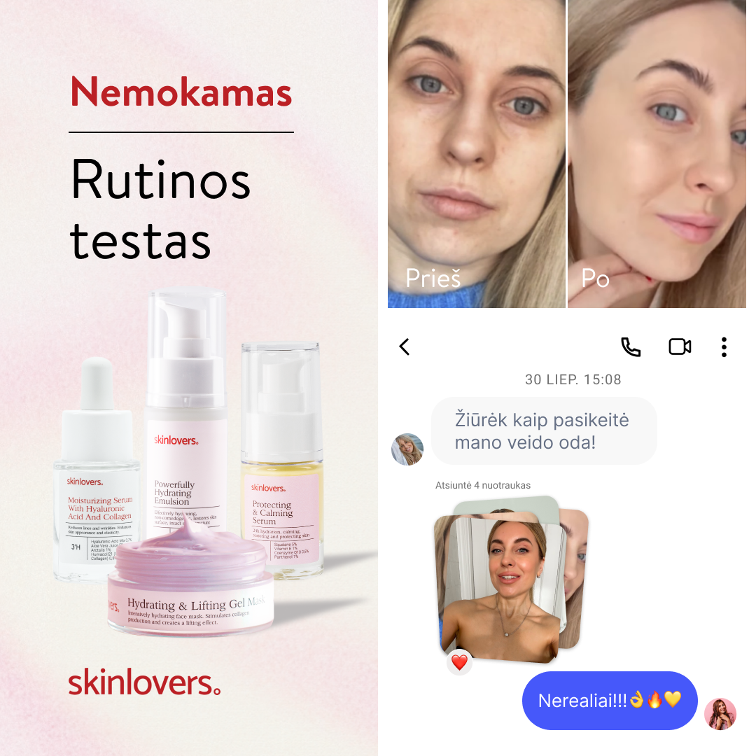 Skinlovers Facebook ad