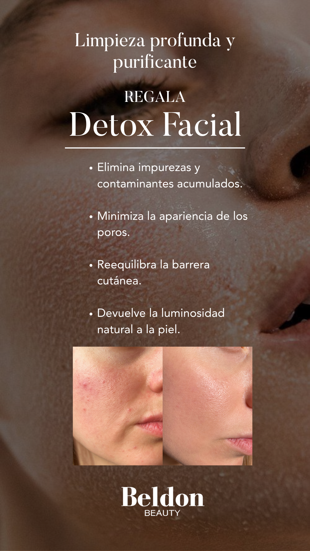 Beldon Beauty Facebook ad