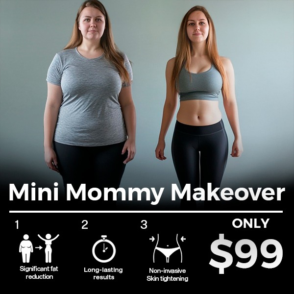 Aesthetics By Aline Facebook ad: only $99