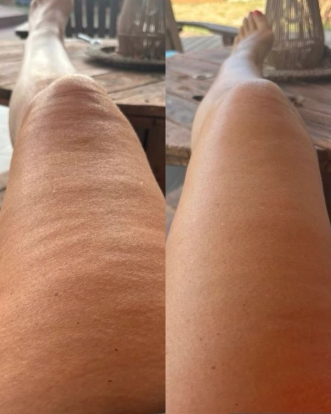 Anastasia Facebook ad: Für alle mit Cellulite trotz Training