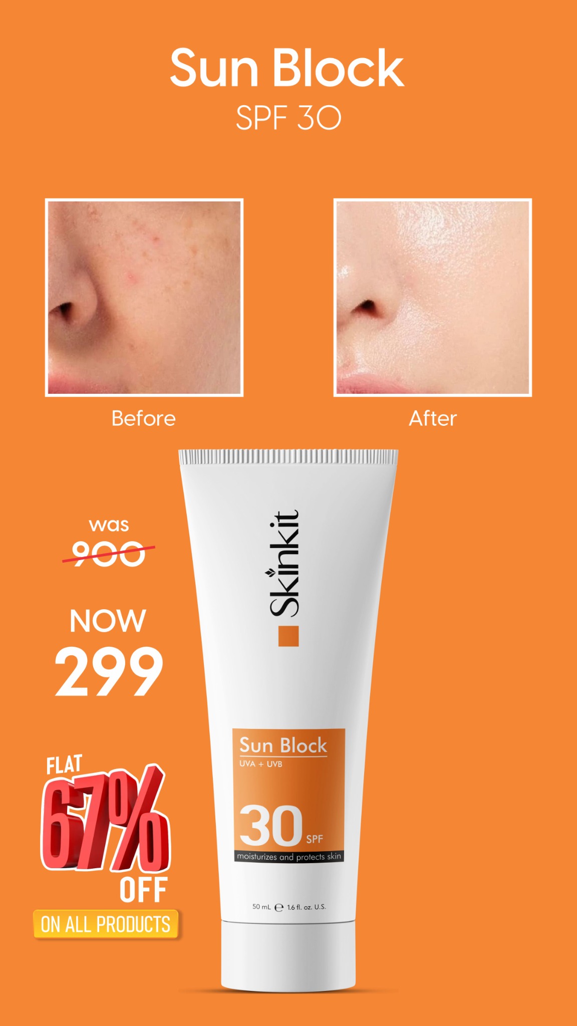 Skin Kit Facebook ad