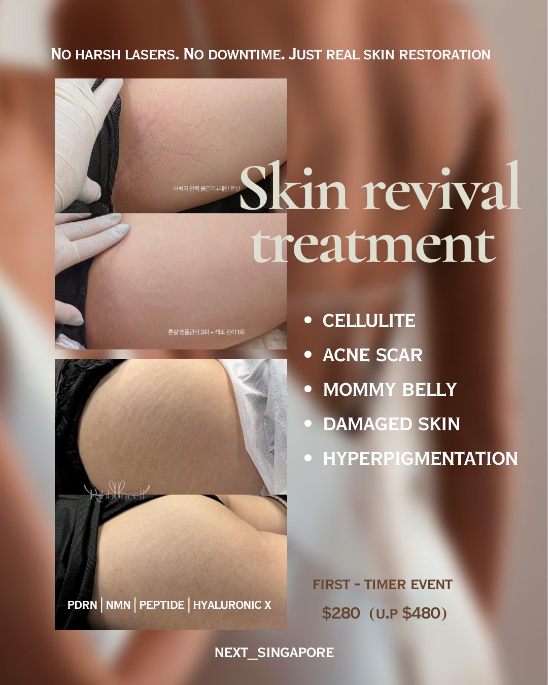 Next 1st Korea Scalp Micro-Pigmentation Facebook ad: FIRST TIMER EXCLUSIVE, SKIN REVIVAL TREATMENT